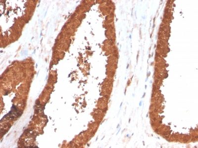 TIGIT / VSTM3 / VSIG9 Monoclonal Mouse Antibody (TIGIT/3017)
