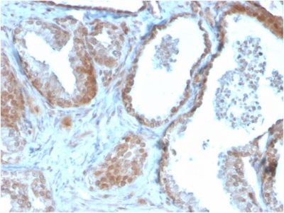 TIGIT / VSTM3 / VSIG9 Monoclonal Mouse Antibody (TIGIT/3106)