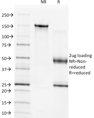 TIMP1 Monoclonal Mouse Antibody (2A5)