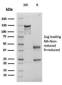 TIMP1 Recombinant Monoclonal Mouse Antibody (rTIMP1/1710)