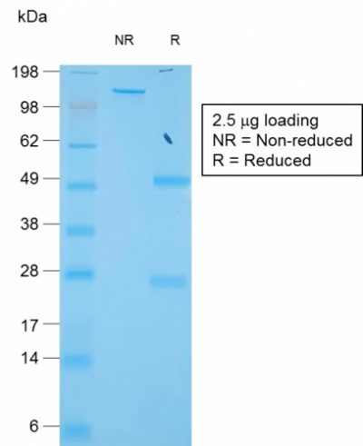 TIMP1 Recombinant Monoclonal Rabbit Antibody (TIMP1/1944R)