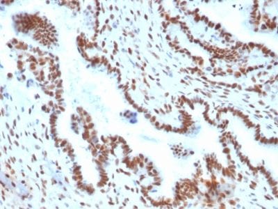 TLE1 Monoclonal Mouse Antibody (TLE1/2051)