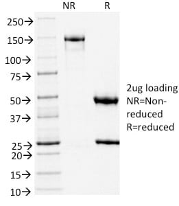 TLE1 Monoclonal Mouse Antibody (TLE1/2051)