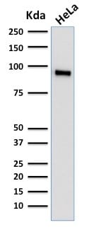 TLE1 Monoclonal Mouse Antibody (TLE1/2062)