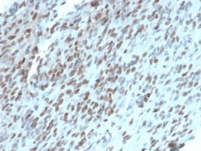 TLE1 Monoclonal Mouse Antibody (TLE1/2062)