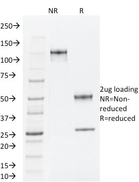 TLE1 Monoclonal Mouse Antibody (TLE1/2062)