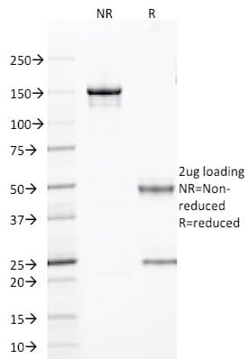 TLE1 Monoclonal Mouse Antibody (TLE1/2085)