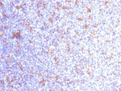 TNFSF15 / VEGI Monoclonal Mouse Antibody (VEGI/1283)
