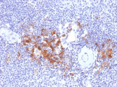 TRAF1 Monoclonal Mouse Antibody (TRAF1/2770)