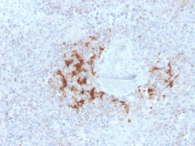 TRAF1 Monoclonal Mouse Antibody (TRAF1/3298)