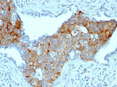 TRIM29 Monoclonal Mouse Antibody (TRIM29/1041)