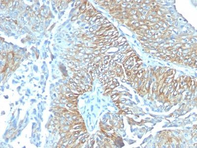 TRIM29 Monoclonal Mouse Antibody (TRIM29/1041)