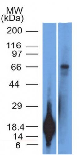 TRIM29 Monoclonal Mouse Antibody (TRIM29/1042)