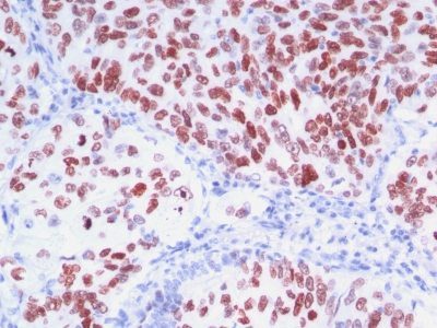 TTF-1 / NKX2.1 Monoclonal Mouse Antibody (8G7G3/1 + NX2.1/690)