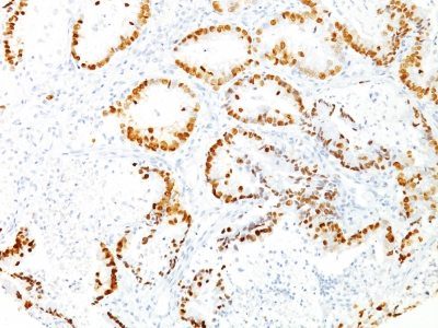 TTF-1 / NKX2.1 Monoclonal Mouse Antibody (8G7G3/1)