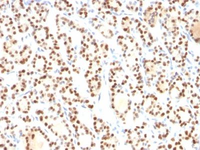 TTF-1 / NKX2.1 Monoclonal Mouse Antibody (8G7G3/1)