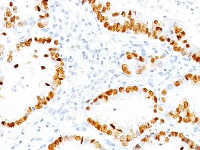 TTF-1 / NKX2.1 Monoclonal Mouse Antibody (NX2.1/690)