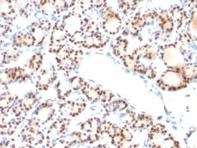 TTF-1 / NKX2.1 Monoclonal Mouse Antibody (NX2.1/690)