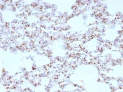 TTF-1 / NKX2.1 Monoclonal Mouse Antibody (NX2.1/690)