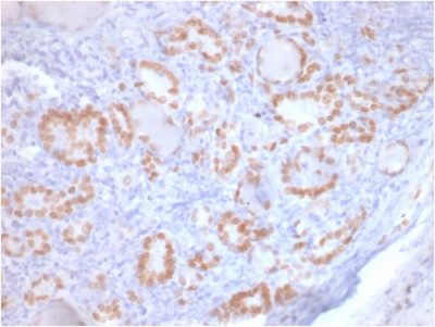 TTF-1 / NKX2.1 Recombinant Monoclonal Mouse Antibody (rNX2.1/690)