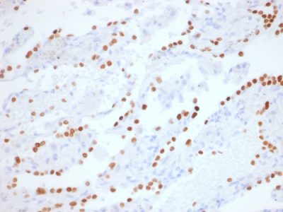 TTF-1 / NKX2.1 Recombinant Monoclonal Rabbit Antibody (NX2.1/1855R)