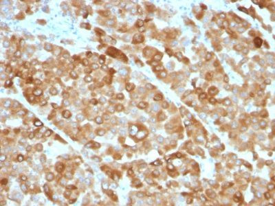 Tyrosinase Monoclonal Mouse Antibody (OCA1/812)