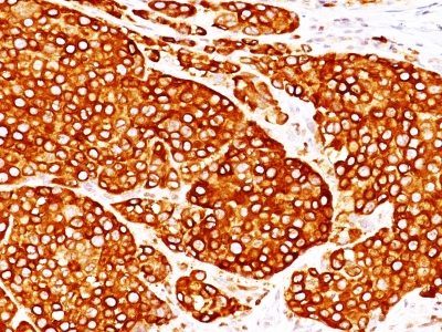 Tyrosinase Monoclonal Mouse Antibody (T311 + OCA1/812)
