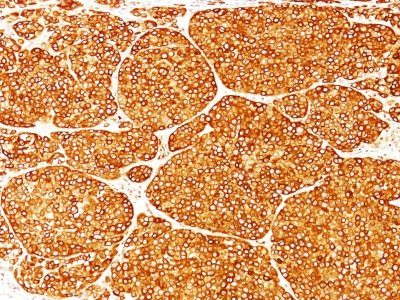 Tyrosinase Monoclonal Mouse Antibody (T311)
