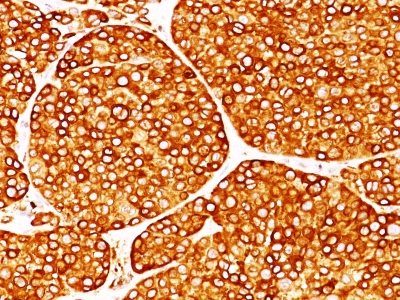 Tyrosinase Monoclonal Mouse Antibody (T311)