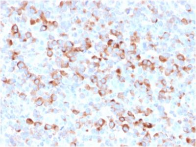 Tyrosinase Recombinant Monoclonal Mouse Antibody (rOCA1/812)