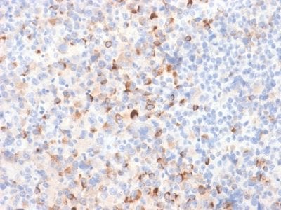 Tyrosinase Recombinant Monoclonal Rabbit Antibody (TYR/2024R)