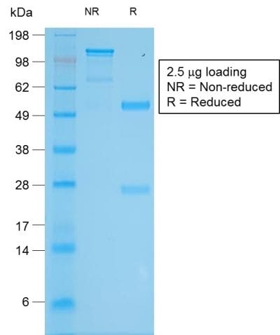 Tyrosinase Recombinant Monoclonal Rabbit Antibody (TYR/2024R)