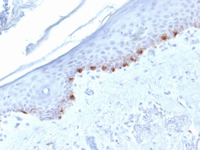 Tyrosinase Related Protein-1 (TYRP1) Monoclonal Mouse Antibody (TYRP1/1986)