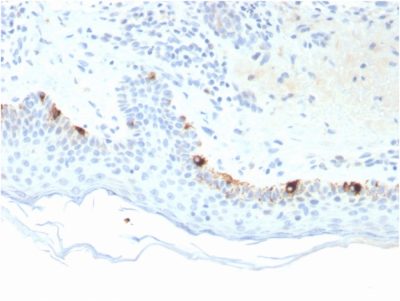 Tyrosinase Related Protein-1 (TYRP1) Monoclonal Mouse Antibody (TYRP1/3281)