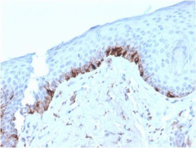 Tyrosinase Related Protein-1 (TYRP1) Monoclonal Mouse Antibody (TYRP1/3282)