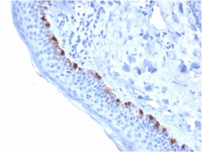 Tyrosinase Related Protein-1 (TYRP1) Monoclonal Mouse Antibody (TYRP1/3284)