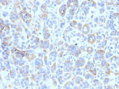 Tyrosinase Related Protein-1 (TYRP1) Monoclonal Mouse Antibody (TYRP1/807)