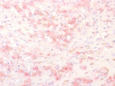 Tyrosinase Related Protein-1 (TYRP1) Polyclonal Rabbit Antibody