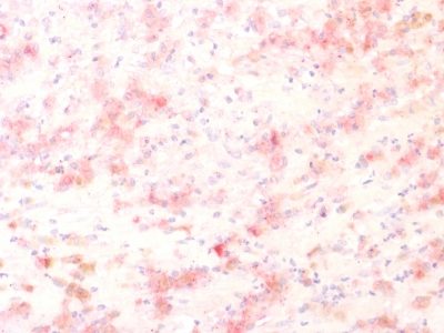 Tyrosinase Related Protein-1 (TYRP1) Recombinant Monoclonal Rabbit Antibody (TYRP1/1564R)