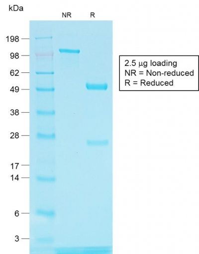 Tyrosinase Related Protein-1 (TYRP1) Recombinant Monoclonal Rabbit Antibody (TYRP1/1564R)