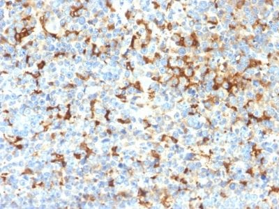 Tyrosinase Related Protein-1 (TYRP1) Recombinant Monoclonal Rabbit Antibody (TYRP1/2340R)