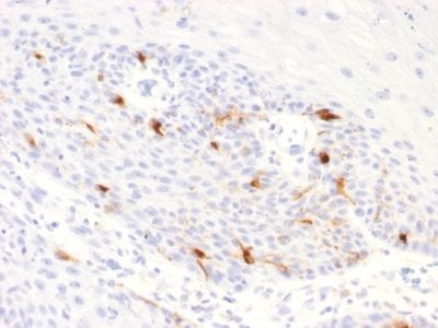 Tyrosinase Related Protein-1 (TYRP1) Recombinant Monoclonal Rabbit Antibody (TYRP1/2340R)