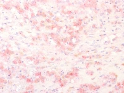 Tyrosinase Related Protein-1 (TYRP1) Recombinant Monoclonal Rabbit Antibody (TYRP1/2340R)