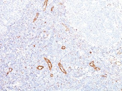 VEGF Monoclonal Mouse Antibody (VEGF/1063)