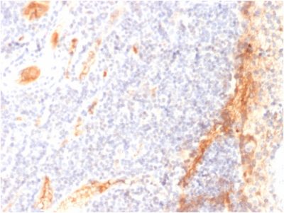 VEGF Monoclonal Mouse Antibody (VG1)