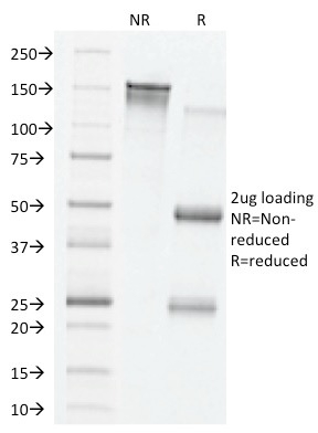 VEGF Monoclonal Mouse Antibody (VG76e)