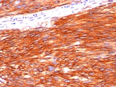 VEGFR2 / Flk-1 / KDR3 / CD309 Monoclonal Mouse Antibody (KDR721)
