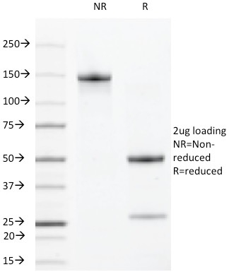 VEGFR2 / Flk-1 / KDR3 / CD309 Monoclonal Rat Antibody (DC101)