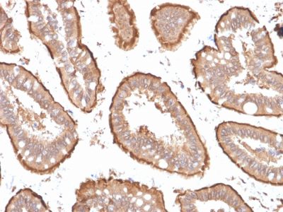Villin Monoclonal Mouse Antibody (VIL1/1314 + VIL1/2376)