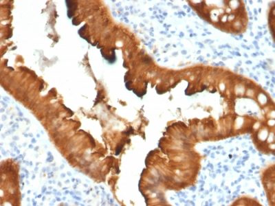 Villin Monoclonal Mouse Antibody (VIL1/2376)